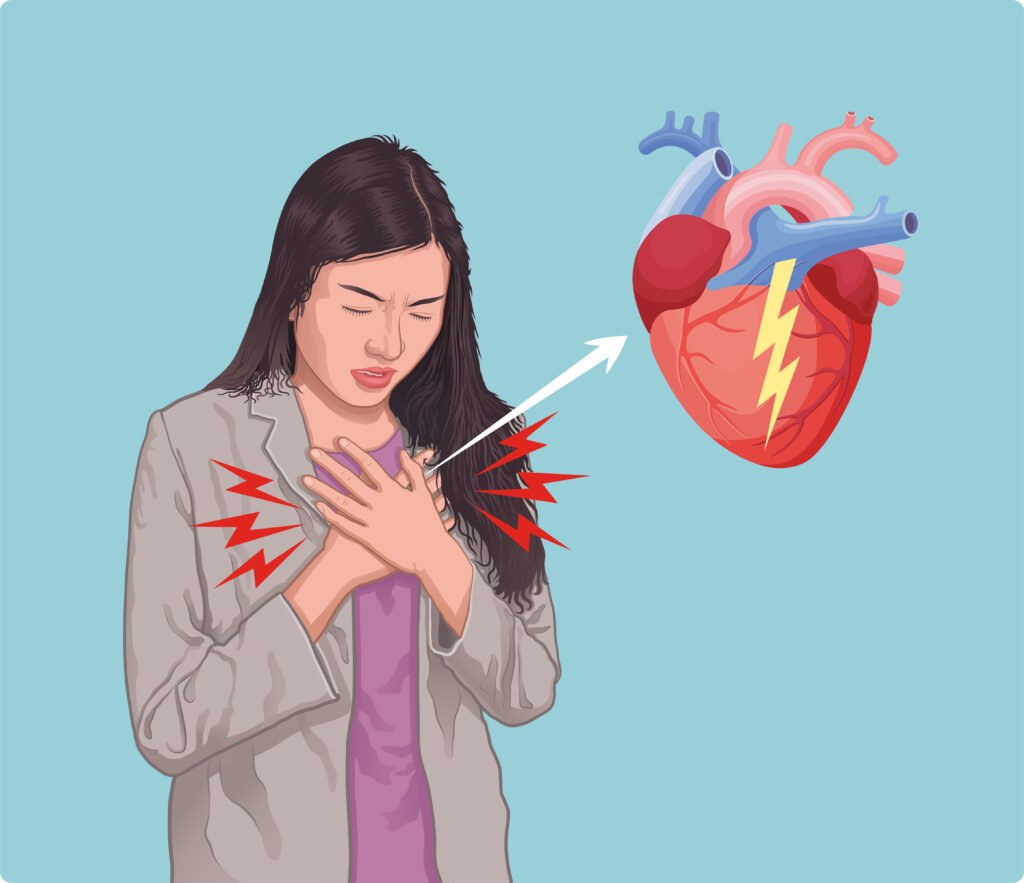 How To Check Heart Blockage Without Angiography