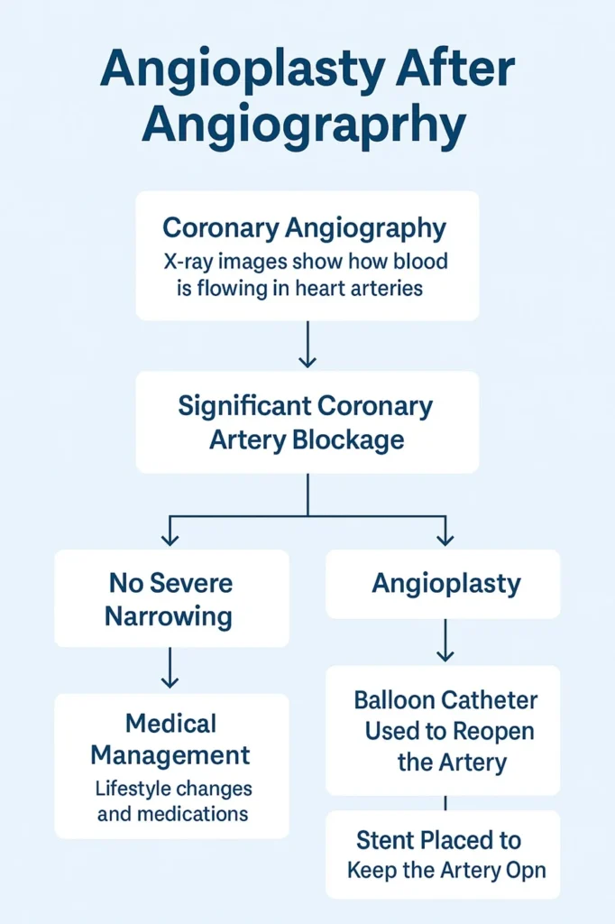 angioplasty